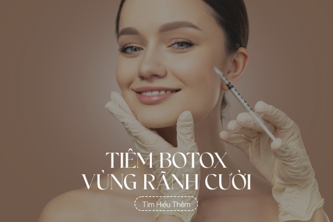 Tiêm botox vùng rãnh cười